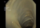 [VIDEO] Nội soi đại tràng và tháo xoắn Alpha trên mô hình đại tràng lợn